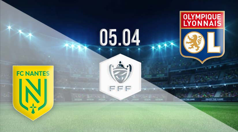 Nantes vs Lyon Prediction: French Cup Match on 05.04.2023